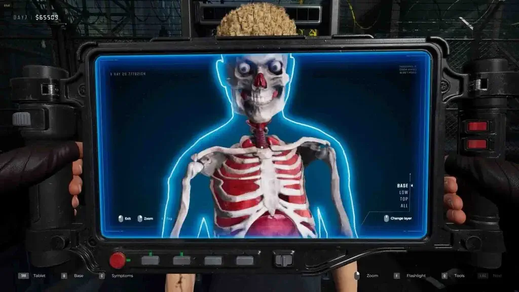 Màn hình máy chụp X-quang soi dị vật và biến đổi xương trong game